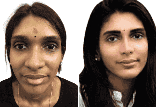 plastic-surgery-story